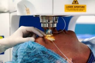 Chirurgie laserového vidění